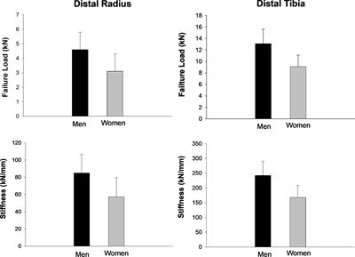 Indices of sarcopenic obesity are important predictors of finite element analysis-derived bone strength in older adults with obesity